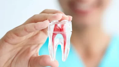 درمان ریشه دندان در سازمان برنامه