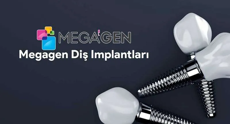 ایمپلنت مگاژن (Megagen)