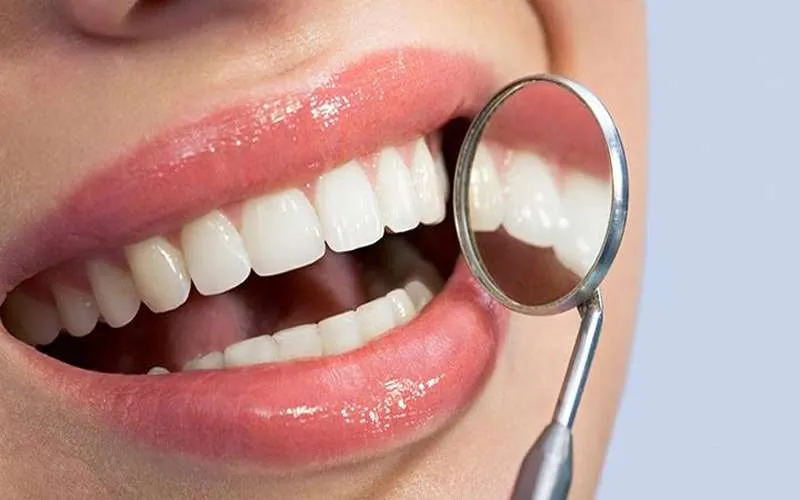 9 مزیت ایمپلنت دندان مدرن