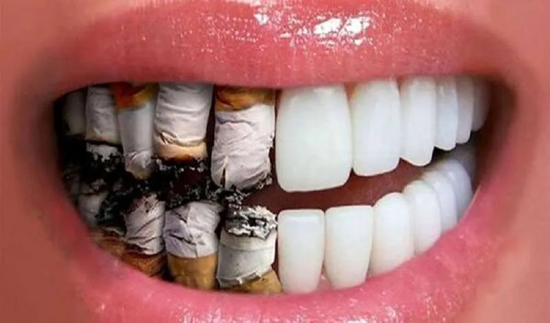 تاثیر سیگار و قلیان بر ایمپلنت دندان