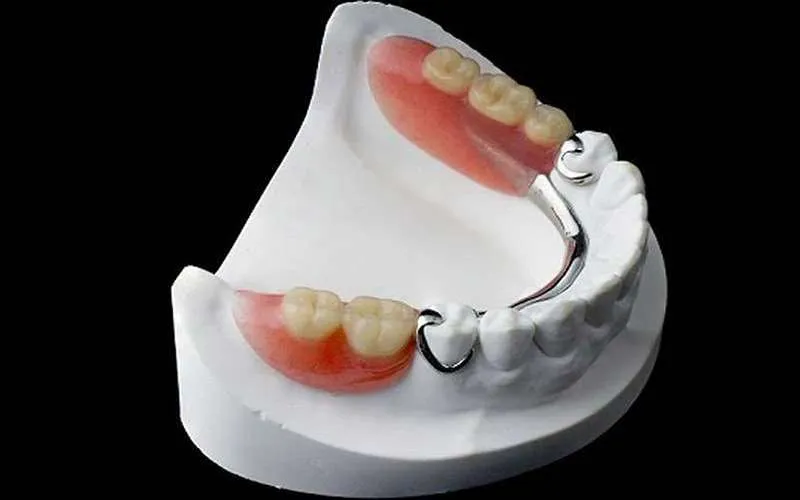 عکس پروتز دندان متحرک 1