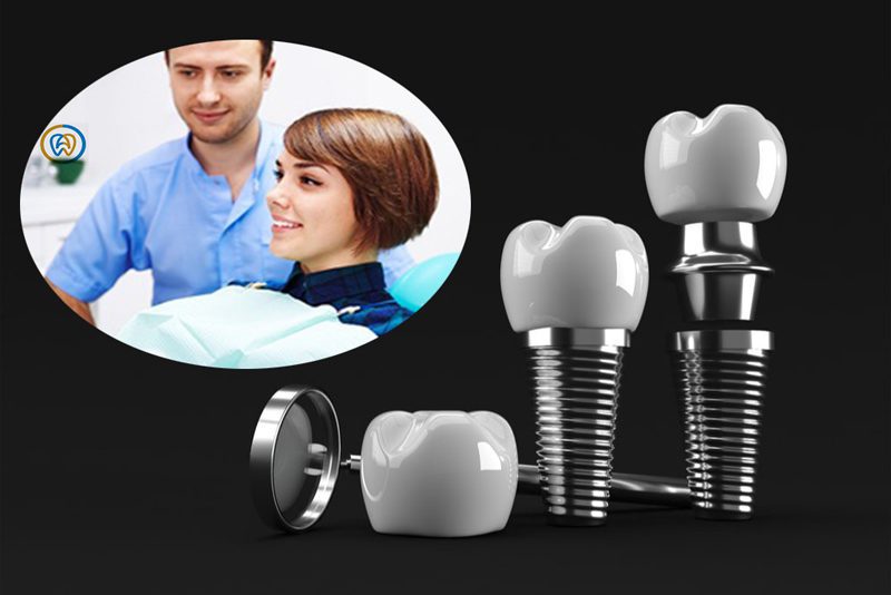 روش های جراحی ایمپلنت