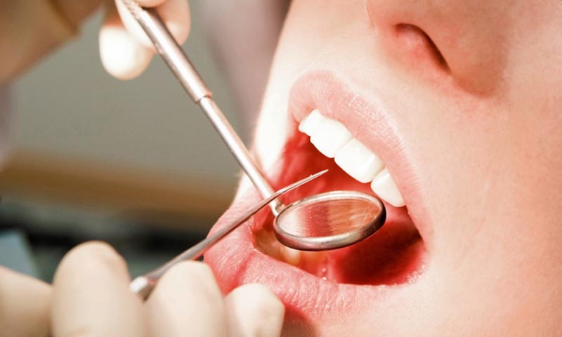 معایب و عوارض کاشت ایمپلنت بعد از کشیدن دندان