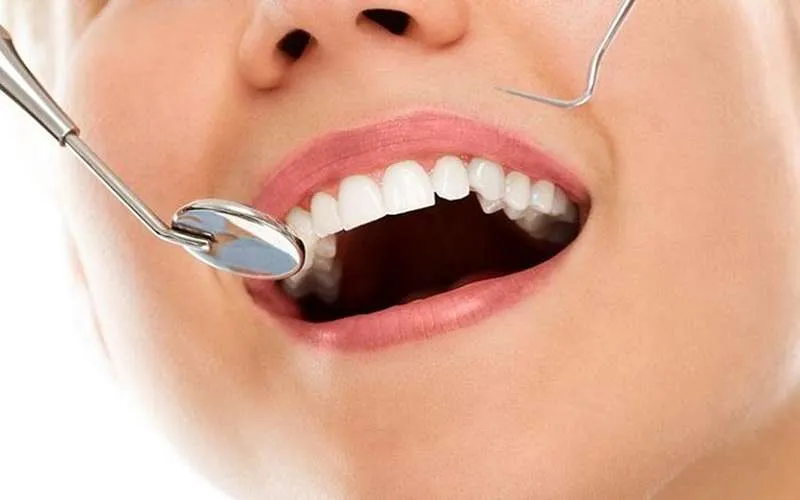نکات لازم برای مراقبت از بریج دندان