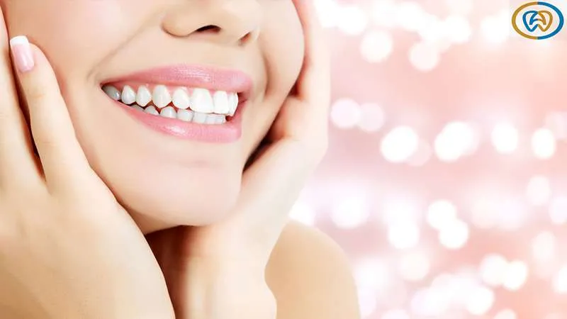 5 مورد از رایج ترین معایب بلیچینگ دندان