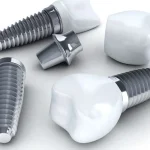 ایمپلنت کره ای دنتیس Dentis