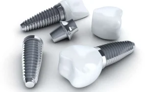 ایمپلنت کره ای دنتیس Dentis