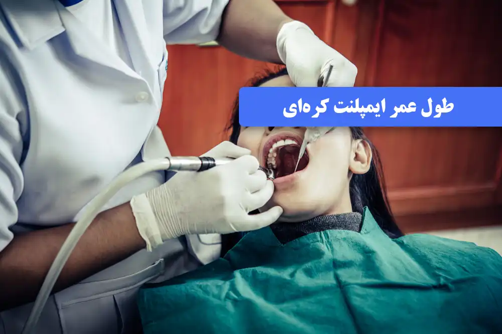 طول عمر ایمپلنت کره‌ای