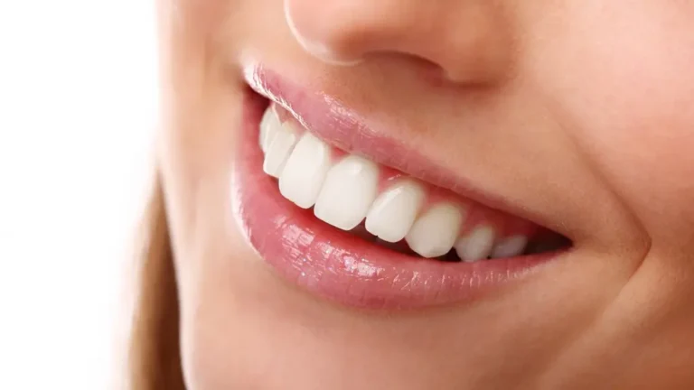 اصلاح طرح لبخند