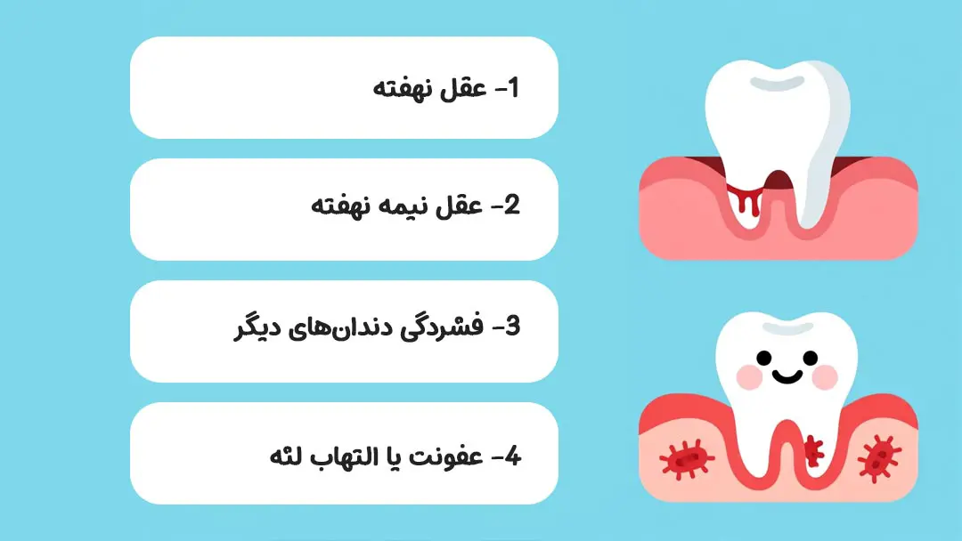 دلایل انجام جراحی دندان عقل