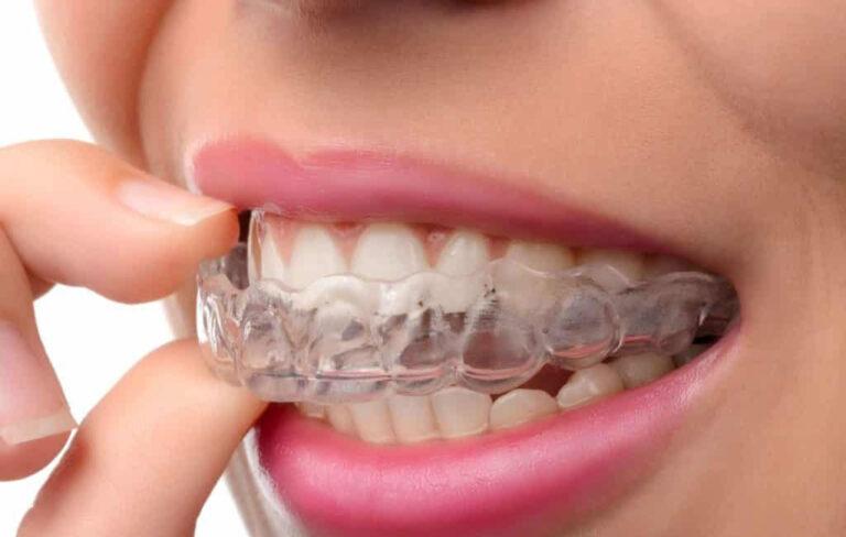 نایت گارد چیست؟