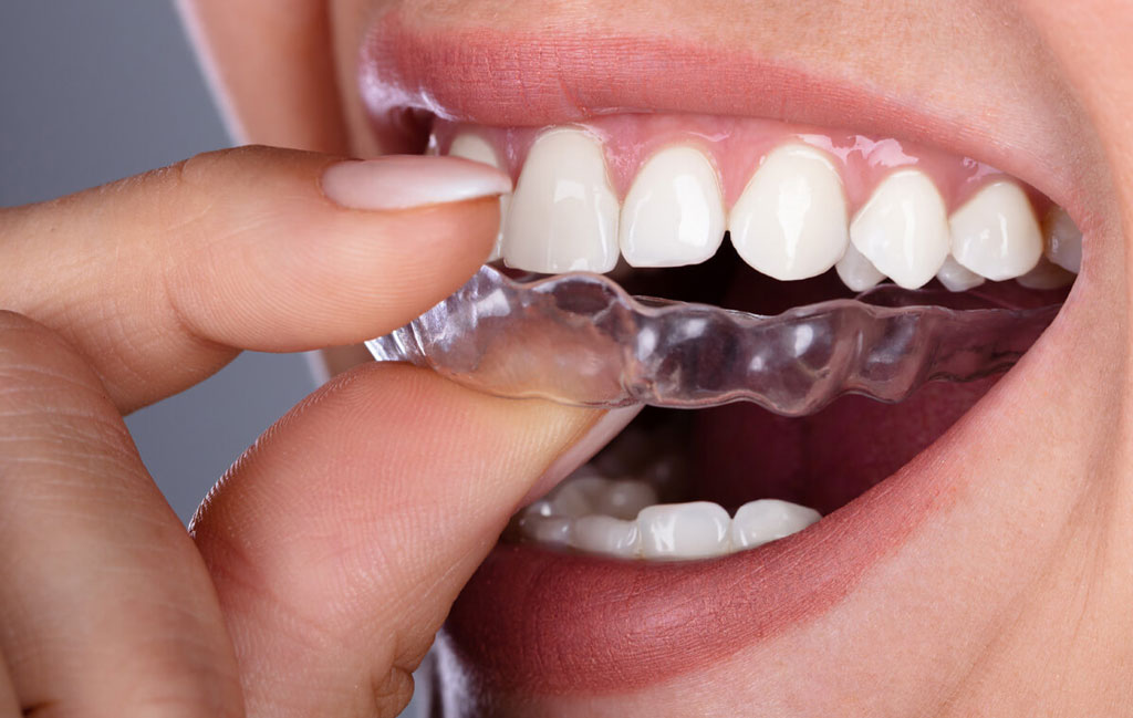 چه موقع باید از نایت گارد استفاده کنیم؟