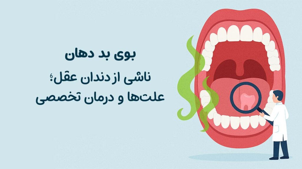 بوی بد دهان ناشی از دندان عقل