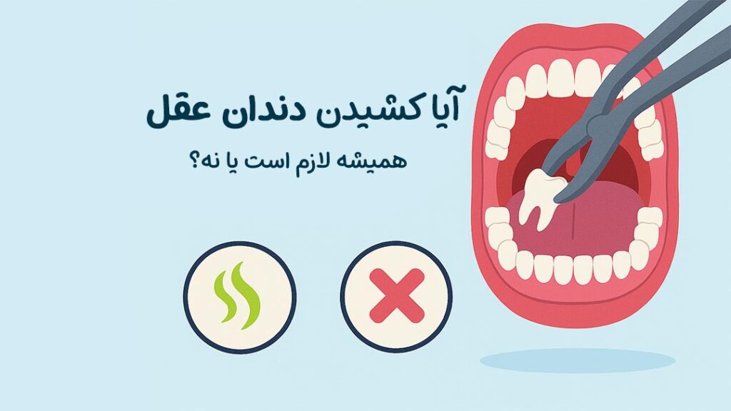 آیا کشیدن دندان عقل همیشه لازم است یا نه؟